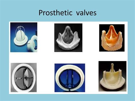 Surgical Treatment Of Valvular Heart Diseases