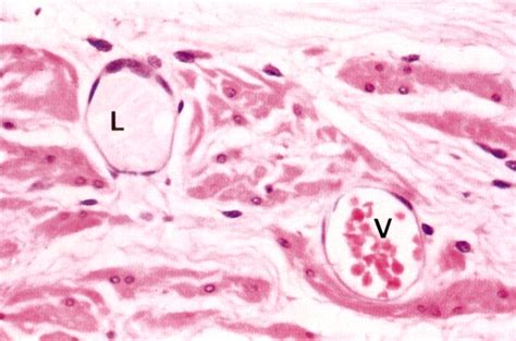 Venule. Causes, symptoms, treatment Venule