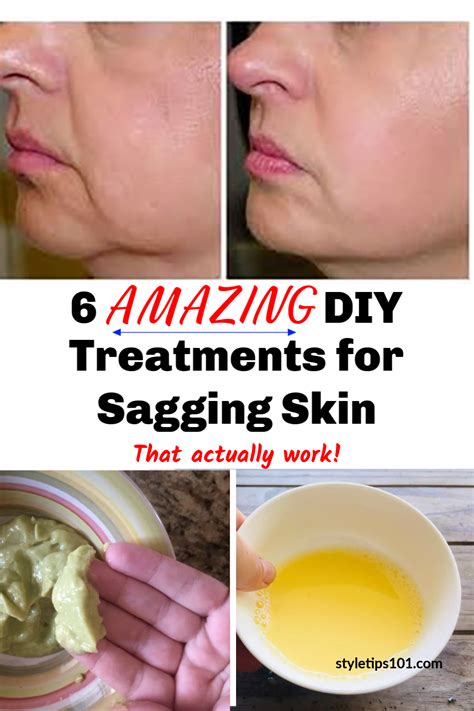 Diy Treatments For Saggy Skin