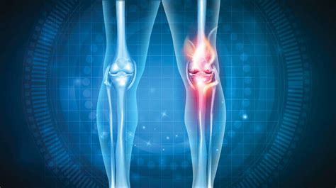 Natural Knee Pain Relief With Applied Kinesiology The Nhcaa