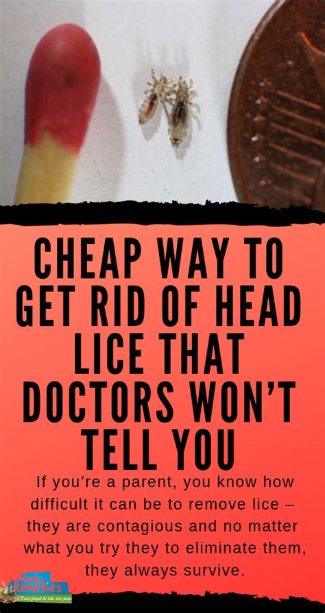 Cheap Way To Get Rid Of Head Lice That Doctors Wont Tell You Lice