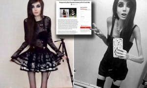 Is Eugenia Cooney Video Blogger Promoting Anorexia Petition To Ban Her