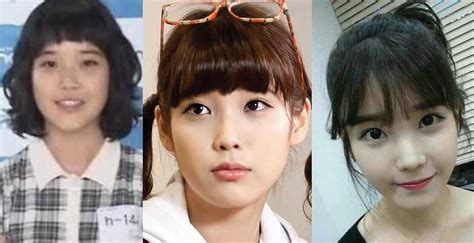 Iu Plastic Surgery Before And After Pictures 2021