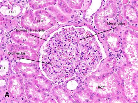 American Urological Association Kidney Renal Corpuscle Glomerulus