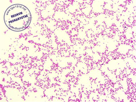 Pseudomonas Aeruginosa Gram