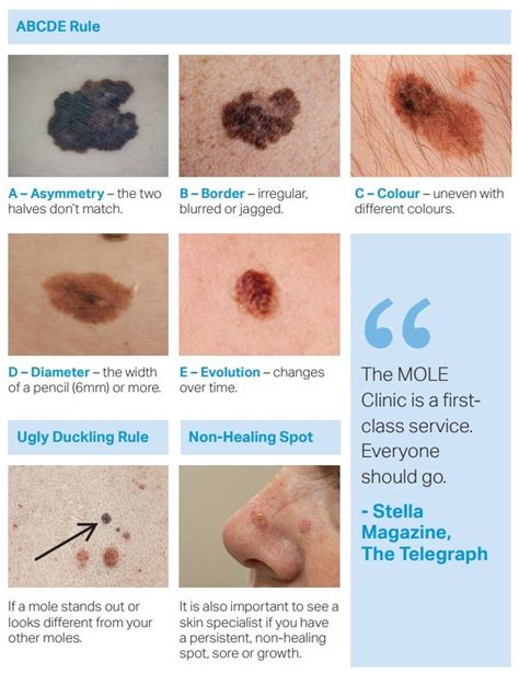 What Is Skin Cancer — The Mole Clinic