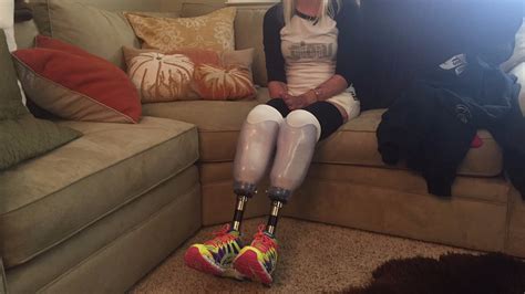 California Amputee Gets Prosthetic Legs From Community S Support Khou