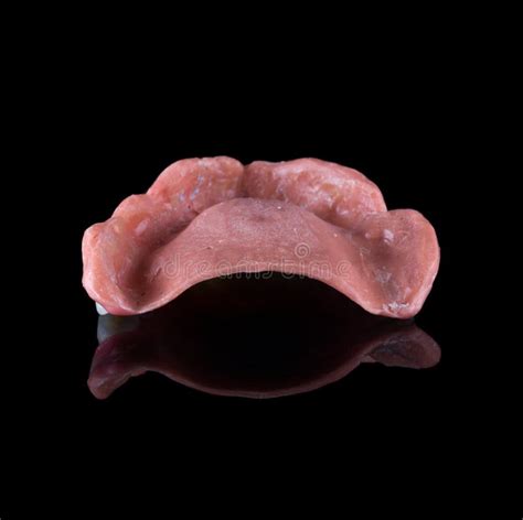 Complete Maxillary Denture â€“ Wax Up And Gingival Contouring Stock