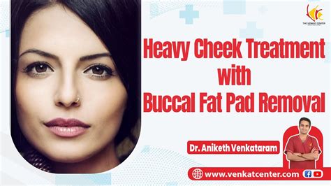 Buccal Fat Pad Removal Surgery For Sharper Cheeks Cheeks Reduction At Venkat Center Bangalore