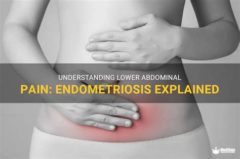 Understanding Lower Abdominal Pain Endometriosis Explained Medshun