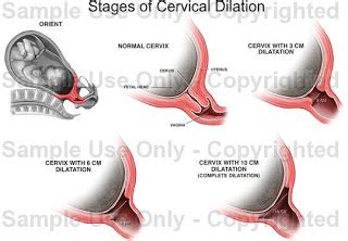 We did not find results for: The Dynamic Duo: Houston - We have Dilation!!