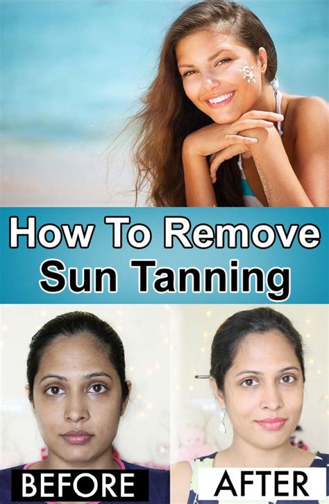 How To Remove Sun Tanning In Sun Tan Tan Skin Skin Tan Removal