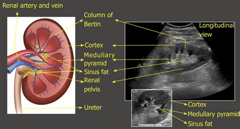 Point Of Care Renal Ultrasonography For The Busy Nephrologist A Pictorial Review