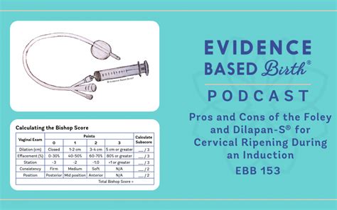 Ebb 153 Pros And Cons Of The Foley And Dilapan S® For Cervical Ripening During An Induction