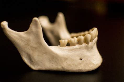 استخوان مورد نیاز برای دریافت ایمپلنت دندان Jaw Bone Animal Teeth