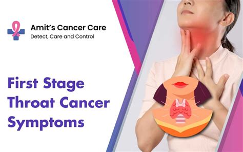 First Stage Throat Cancer Symptoms Diagnosis And Treatment