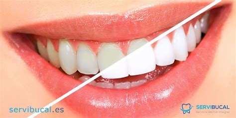 ¿qué Es La Odontología Estética Y Qué Problemas Puede Solucionar