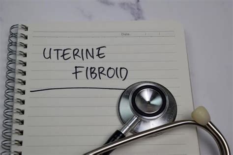 Can Fibroids Affect Your Chances Of Pregnancy Things To Know