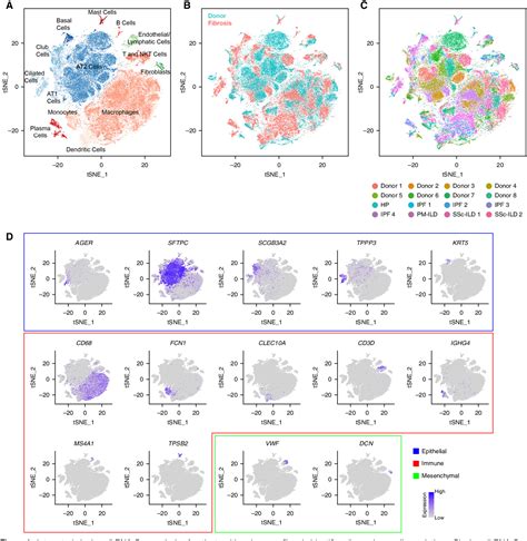 Figure 1 From Single Cell Transcriptomic Analysis Of Human Lung