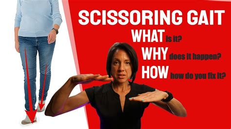 What Is Scissoring Gait And How Do You Fix It Youtube