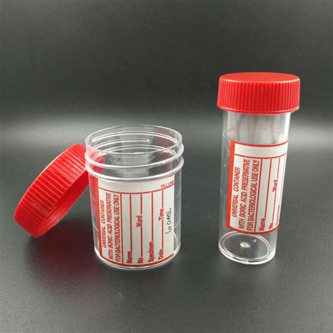 Urine Container With Boric Acid With Label Red Cap Labchem Catalog