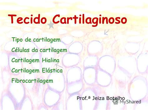 Презентация на тему Tecido Cartilaginoso Tipo De Cartilagem Células