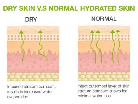 Dry Skin Symptoms And How You Can Treat Them Results Laser Clinic