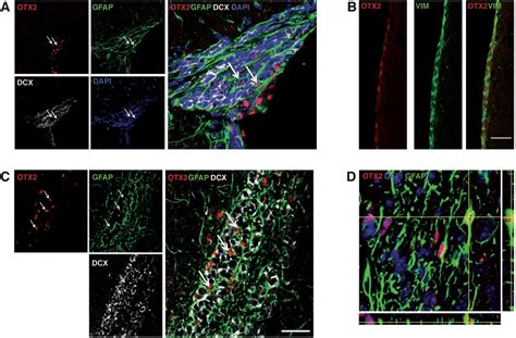 Otx2 Signals From The Choroid Plexus To Regulate Adult Neurogenesis