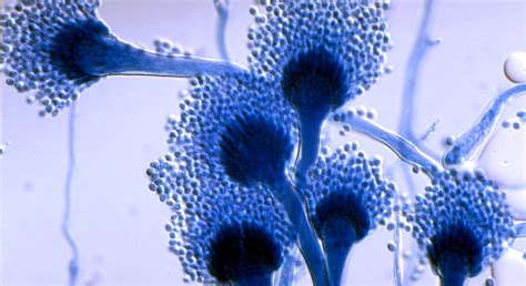 Aspergillus Fumigatus Microscope Trust My Science