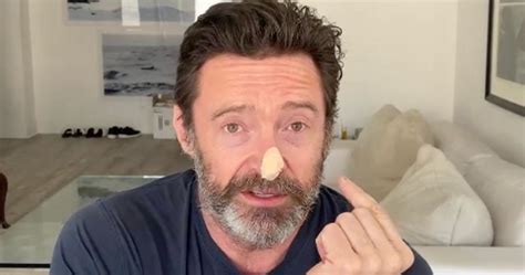 Hugh Jackman Reveals Skin Cancer Biopsies With Nose Bandaged Sunscreen Psa Huffpost Entertainment