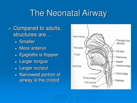 Ppt The Neonatal Airway And Neonatal Intubation Powerpoint