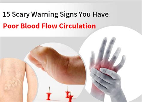 15 Scary Warning Signs You Have Poor Blood Flow Circulation Dr Sam