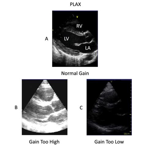 Standard Four Views Of Goal Directed Echocardiography A Parasternal