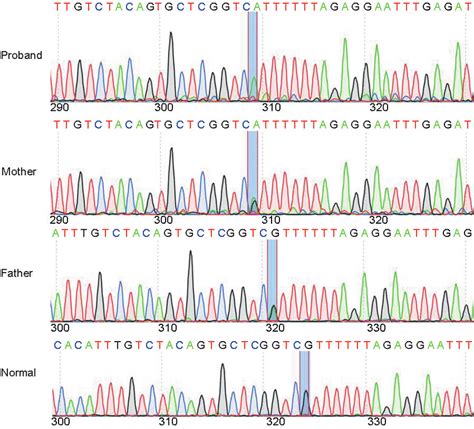 Sanger Sequencing Results Showing The Homozygous C6934ga Mutation In Download Scientific