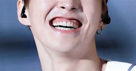 Fans Adore The Gummy Smiles Of Many K Pop Idols But Some Dentists Don T Recommend Them Koreaboo
