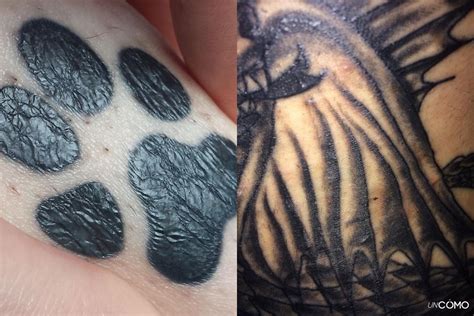 Top 52 Images About White Bumps Tattoo Latest Vn