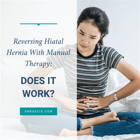 Reversing A Hiatal Hernia How The Exercises Work Artofit