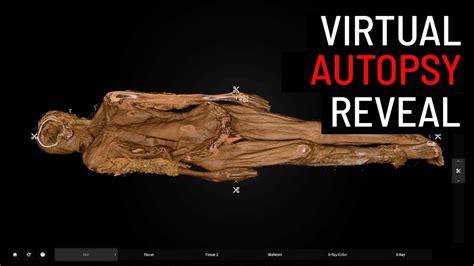 Virtual Human Anatomy