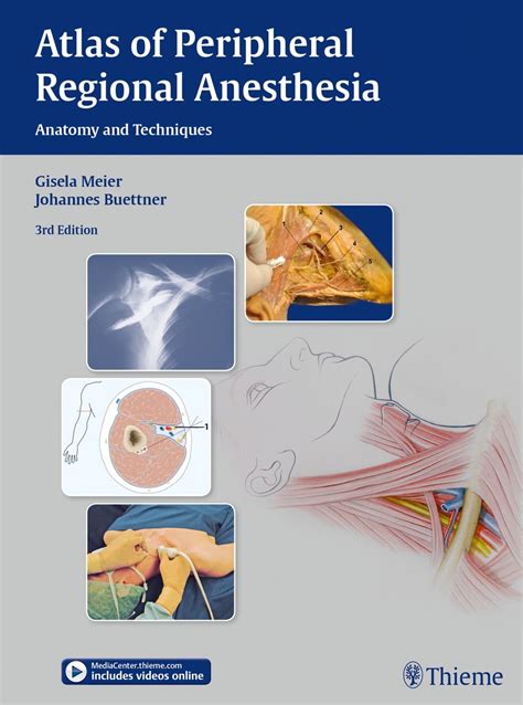 Atlas Of Peripheral Regional Anesthesia 3rd Edition Ebook In 2021