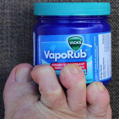 Vicks Vaporub Is One Of Many Different Home Remedies That May Be