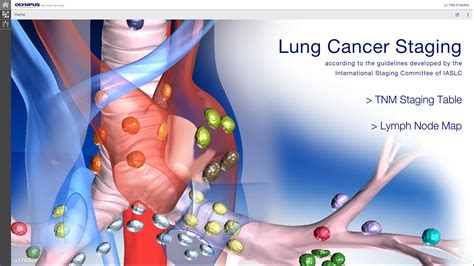 Lung Cancer Staging Table Apk For Android Download