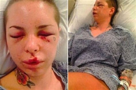 Christy Mack Beating Before And After
