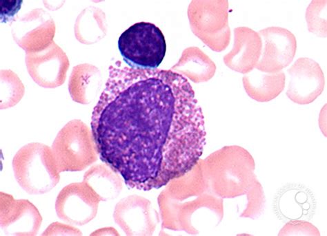 Eosinophilic Myelocyte 1