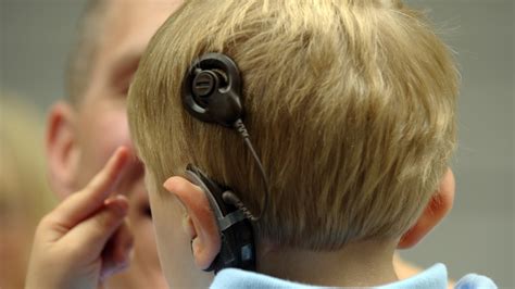 The Technology That Lets Deaf People Hear Could Also Treat Hearing