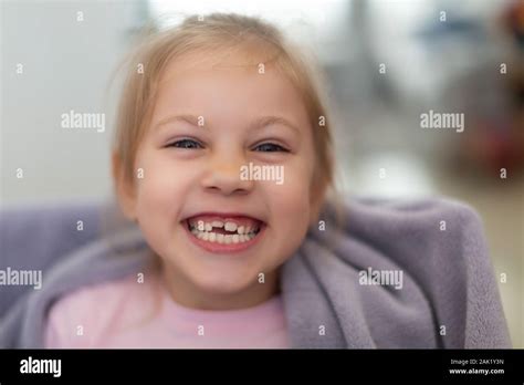 Smile Without Front Tooth Hi Res Stock Photography And Images Alamy