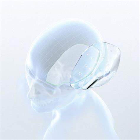 Cranial Implant Aesculap