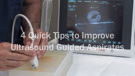 Quick Tips To Improve Ultrasound Guided Aspirates Youtube