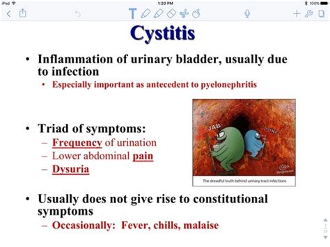 Cystitis Pyelonephritis And Interstitial Nephritis Renal Week 9