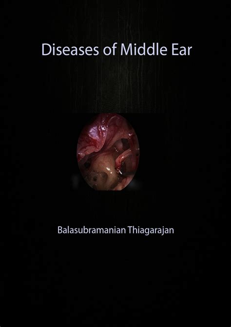 Pdf Diseases Of Middle Ear Cavity