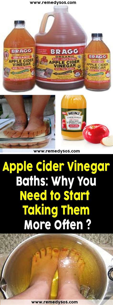 Apple Cider Vinegar Baths Why You Need To Start Taking